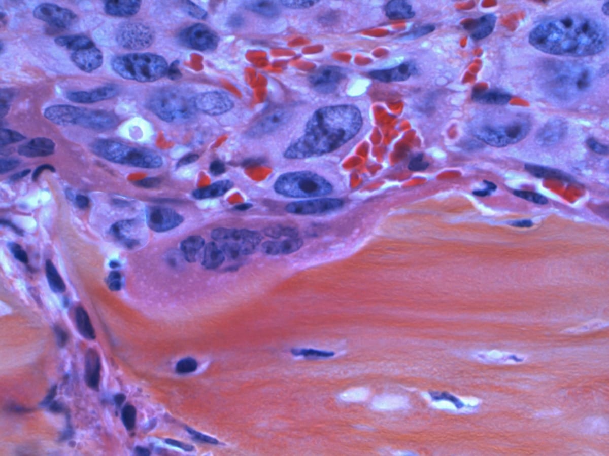 The power of diet and supplements for cancer prevention